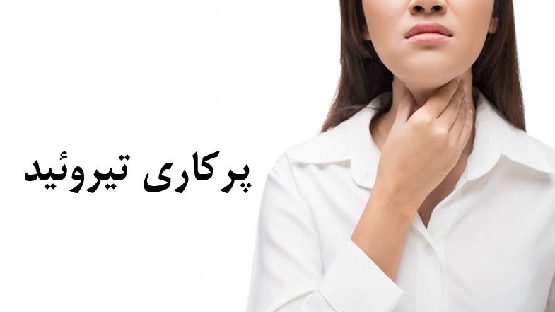 پرکاری تیروئید
