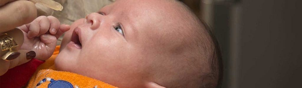 نشانه ریفلاکس در نوزاد