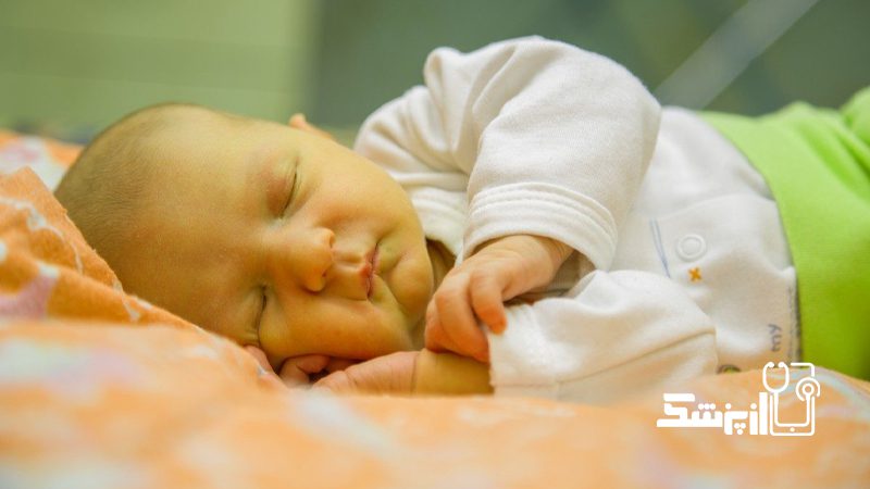 زردی نوزاد درمان
