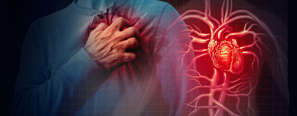 اقدامات لازم برای بیمار مبتلا به سکته قلبی 