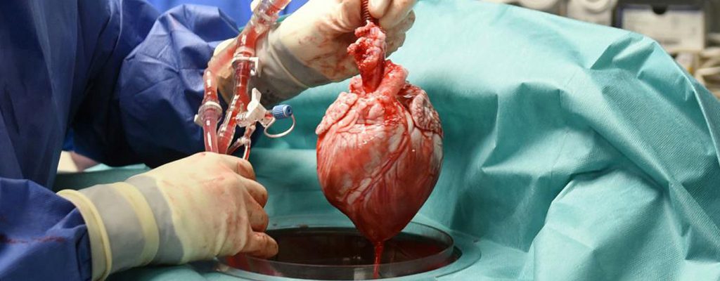 آنچه تمام پزشکان در رابطه با پیوند قلب باید بدانند و اهمیت زمان انجام آن