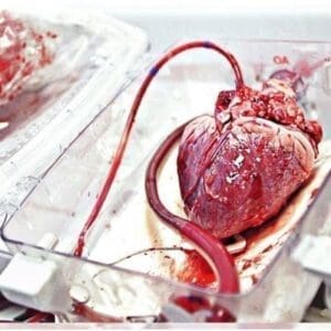 آنچه تمام پزشکان در رابطه با پیوند قلب باید بدانند