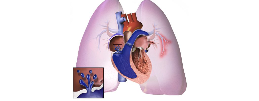 بیماری‌های مرتبط با پزشک متخصص ریه