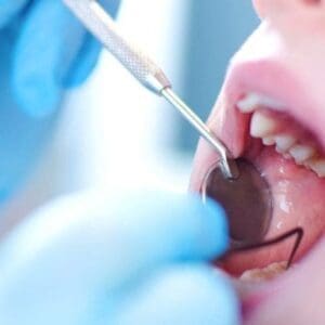 پوسیدگی دندان و عفونت های ادنتوژنیک