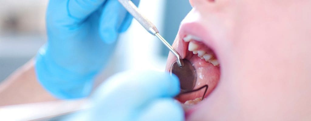 پوسیدگی دندان و عفونت های ادنتوژنیک