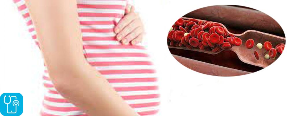 درمان غلظت خون قبل از بارداری
