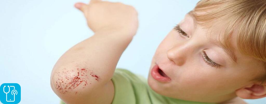 عواملی که باعث عفونت پوست و بافت نرم در کودکان می‌شود؟