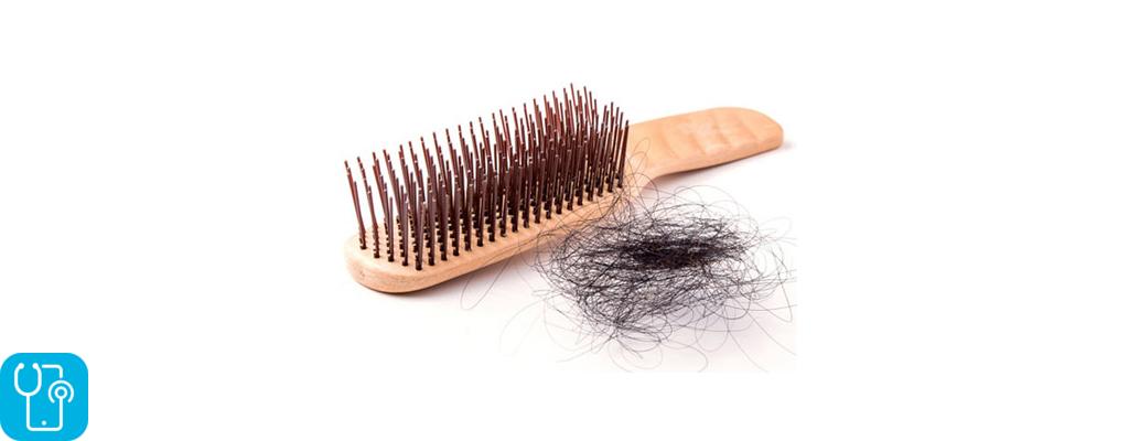نکاتی درباره جلوگیری از ریزش مو
