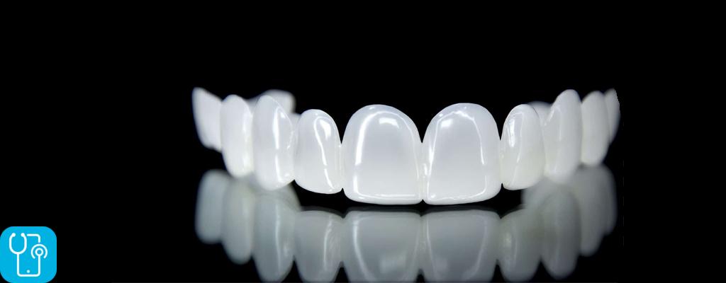 بهترین نوع لمینت دندان کدام است؟