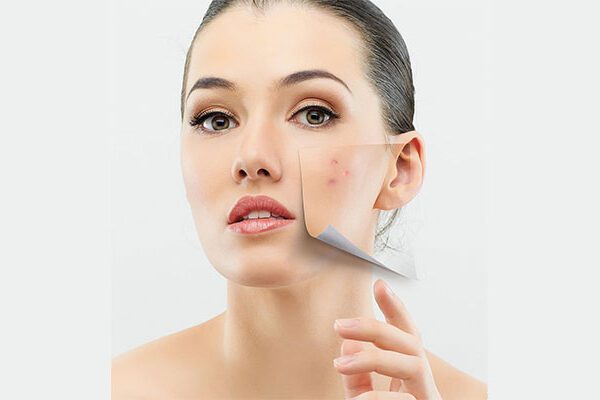 ویزیت آنلاین دکتر پوست