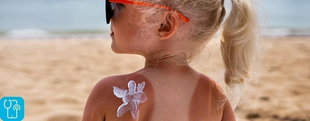 درمان آفتاب سوختگی کودکان