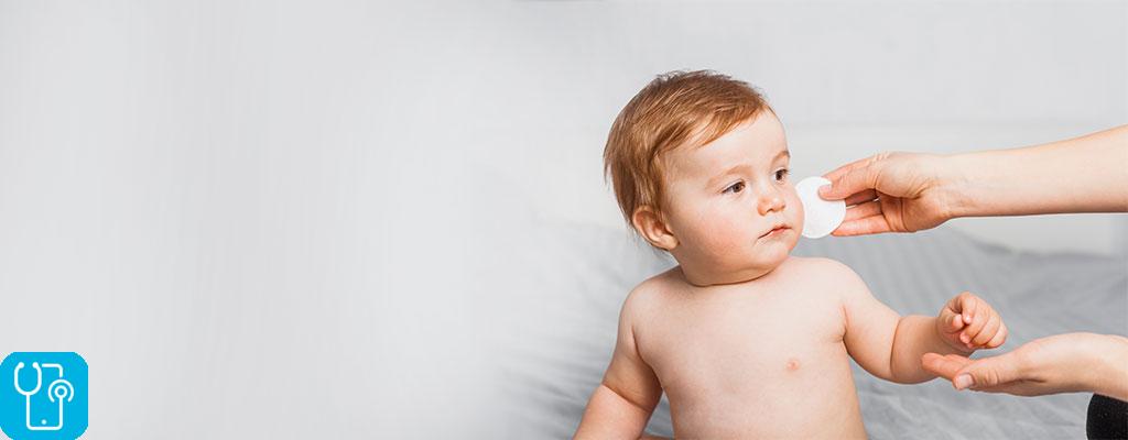 درمان های خانگی پوسته ریزی نوزادان